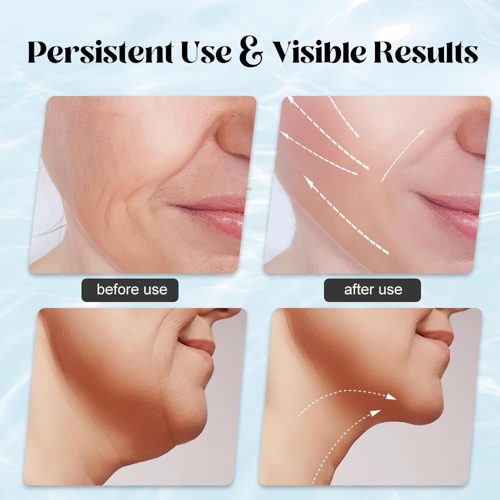 EMS Face Lifting Massager with Red Light Therapy